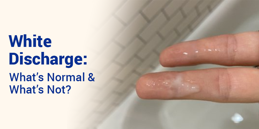 White Discharge: What's Normal and What's Not?